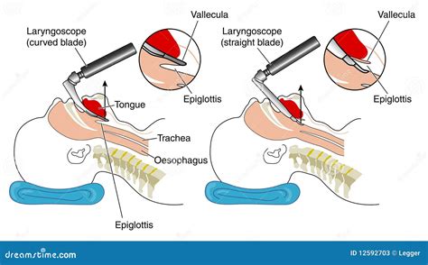 Laryngoscopy: Procedure, Definition & Types